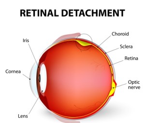 retinal